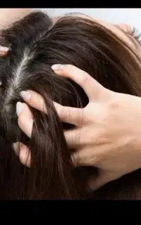 پاکسازی شپش و رشک کاملا تضمینی یکبار امتحان کافیه
