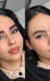 فیبروز تخصصی برای ۱۰نفر اول به مدت ۱۰روز ۱/۹۰۰