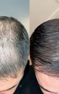 پی ار پی ممنوع