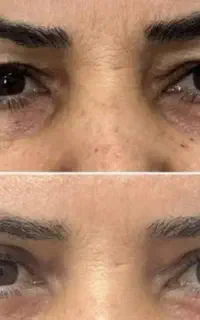 مژده بلفا با قیمت باورنکردنی فقط تا اخر اردیبهشت