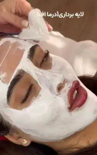 ژل و بوتاکس ویژه بانوان