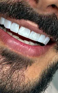 تخفیف عید قربان کامپوزیت ونیر ۱.۹۰۰