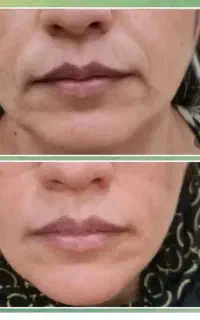 کرم پاور لیفتینگ بیوممتیک
