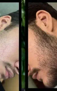 جذاب‌ترین صورت رو مال خودت کن