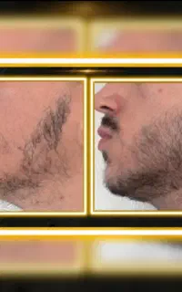 ۳۰ روزه ریشات پرپشت کن