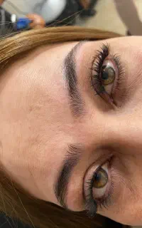 موخوره گیری 200 فر مودائمی کوتاهی کاشت مژه