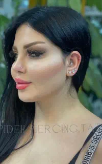 انجامViPپیرسینگ فول بادی ومیکرودرمال