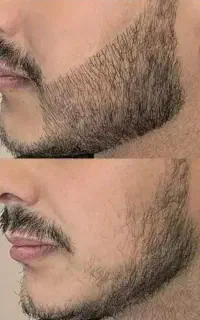 ریشت در نیومده راهکارش اینجاست