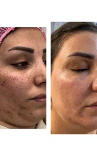 قیشیال تخصصی درمانی