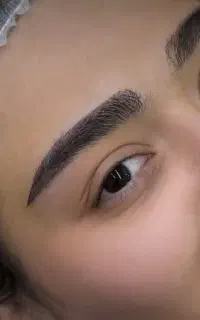 کاشت ابرو