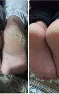 کرم معجزه جوانساز