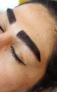 تخفیف ویژه کاشت ابرو