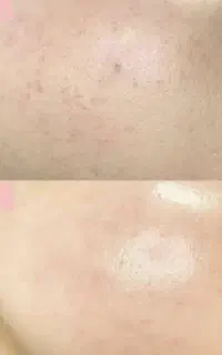آموزش تخصصی فیشیال و پاکسازی با مدرک فنی حرفه‌ای