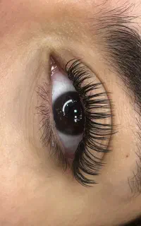 اکستیشن و کاشت هیدن مژه رشت