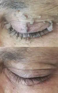 کرم‌ ترمیم کننده و محلول در.ما.ن زگ.یل