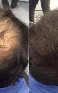 قبل اینکه کاشت کنی این اگهی رو ببین
