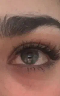 کاشت مژه فقط ۳۶۰