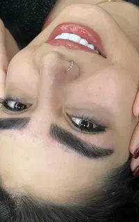 فیبروز و شیدینگ لب کلینیک اطهر