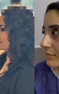 عمل بینی ۵۰م دربیمارستان دراهواز