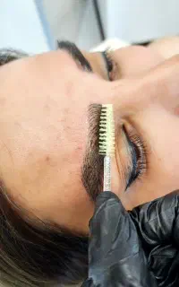 میکروبلیدینگ