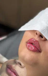 درمان تیرگی های بدن و‌صورت و ژل و بوتاکس کلینیک