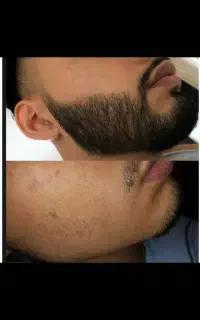 برای چهره ای مردانه‌تر