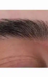 اصلاح صورت