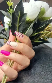 کاشت دست و پا