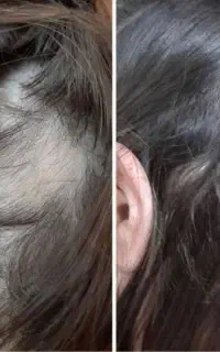 کمکت میکنم از افسردگی در بیای