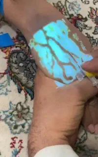رگ گیر حرفه ای