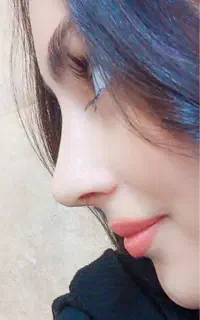 مرکز جراحی رینوپلاستی عمل بینی دکتر سیما صادقزاده
