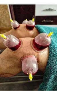 رفع مشکلات کبدی تیرگی پوست خستگی و غلظت خون