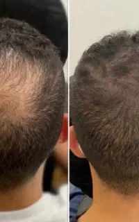 ارائه خدمات زیبایی در کلینیک رفع لک پی ارپی