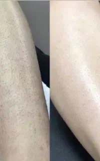 گلسانا کلینیک لیزر و زیبایی سنندج