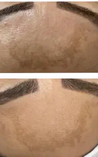 فیشال و پاکسازی پوست بانوان و آقایان