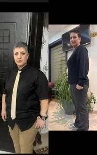لاغری در یک جلسه فقط با ۱۳ میلیون