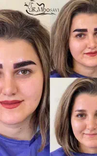 کاشت مو کاشت ابرو استخدام