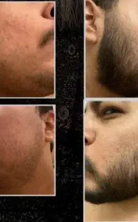 ریش و سیبیل تضمینی