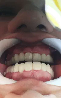 خدمات دندان پزشکی آرامش(اقساط بلند مدت)