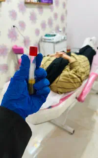 تخفیف ویژه prp