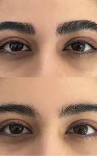 خدمات‌آموزش‌لیفت مدرک‌درآمدمیلیونی پیشرفته‌حرفه‌ای