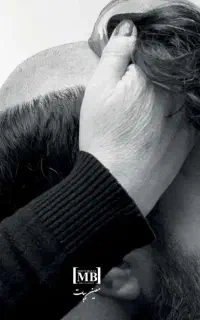 پروتز مو جایگزین کاشت مو