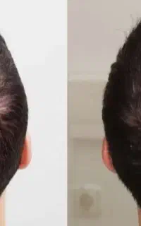 وقتی ظاهر مهمه