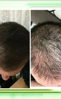یک انتخاب تازه برای تو