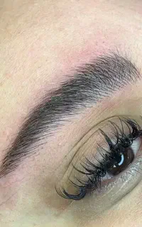 مرکز تخصصی فیبروز به سبک (هایپر نچرال وموی)