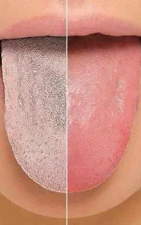 سونوگرافی بدن از روی زبان