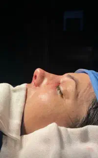 جراحی زیبایی بینی توسط جراح متخصص گوش و‌حلق و بینی