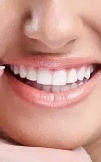انجام کلیه خدمات دندان پزشکی و ارتودنسی کودکان