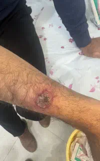 کلینیک زخم و سوختگی شفابخش