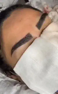 شرایط ویژه کاشت ابرو